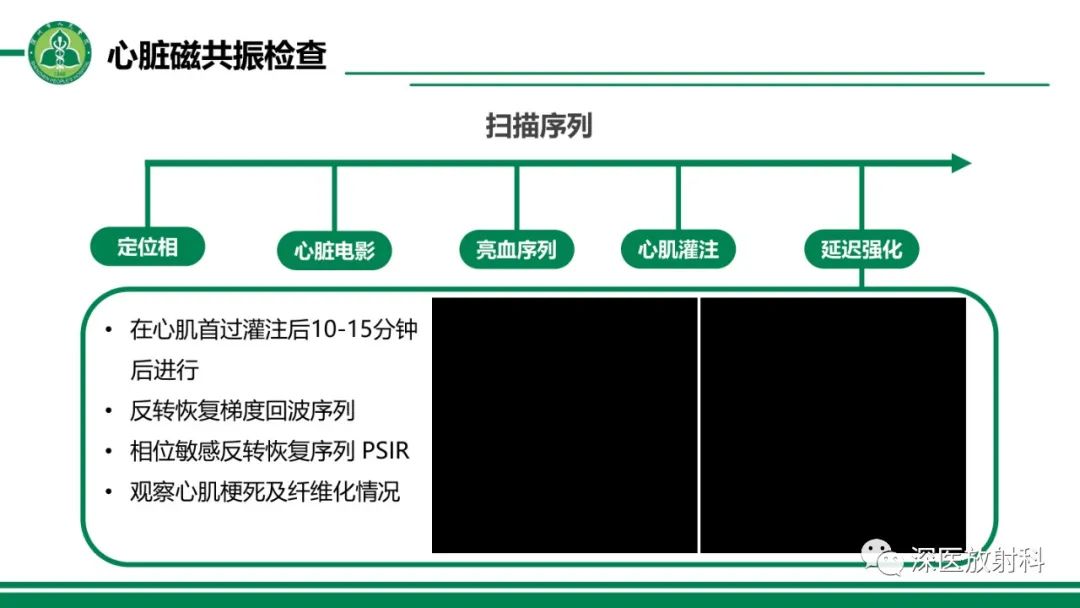 影像PPT - 【PPT】心脏磁共振成像-19