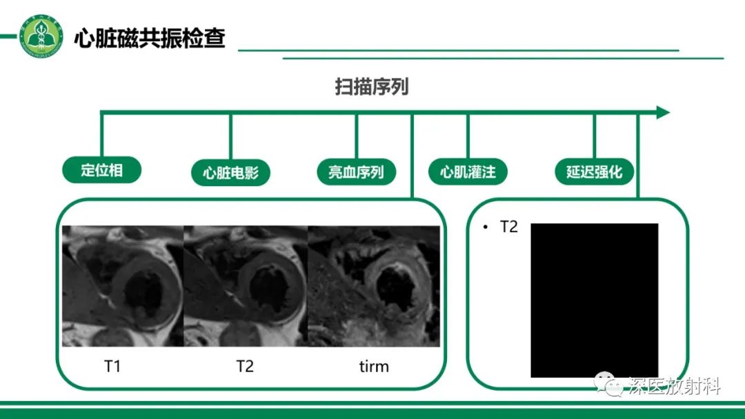影像PPT - 【PPT】心脏磁共振成像-20