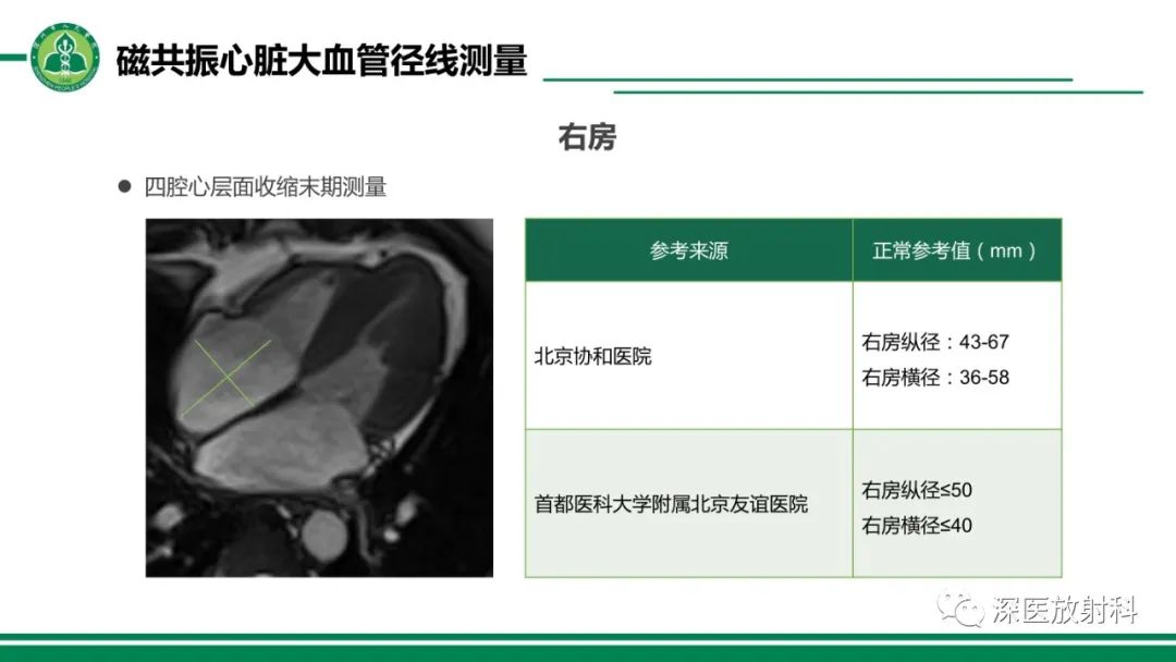 影像PPT - 【PPT】心脏磁共振成像-30