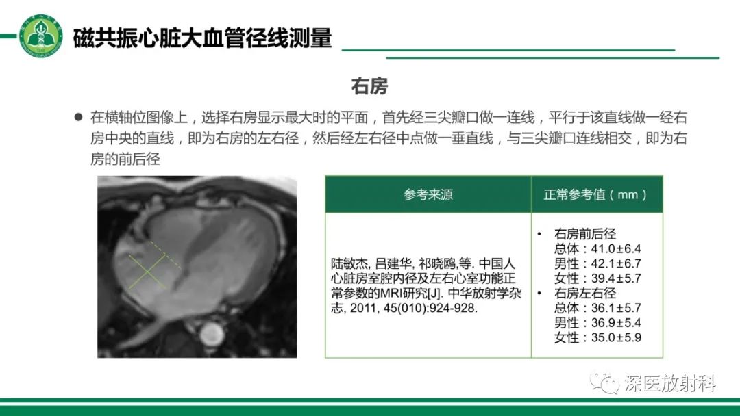影像PPT - 【PPT】心脏磁共振成像-29