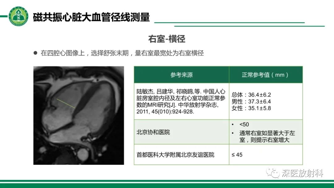 影像PPT - 【PPT】心脏磁共振成像-31