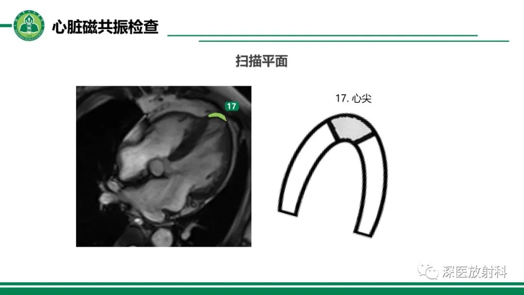 影像PPT - 【PPT】心脏磁共振成像-10