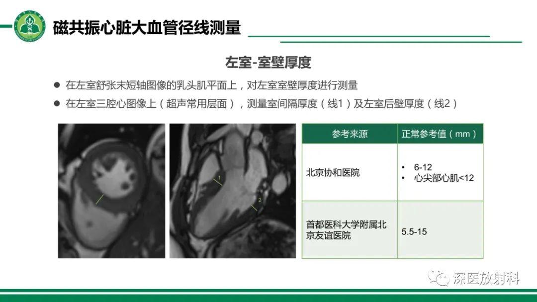 影像PPT - 【PPT】心脏磁共振成像-28