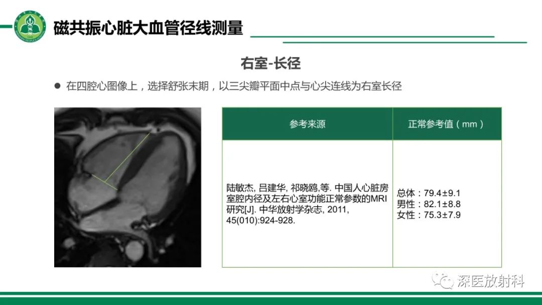 影像PPT - 【PPT】心脏磁共振成像-33