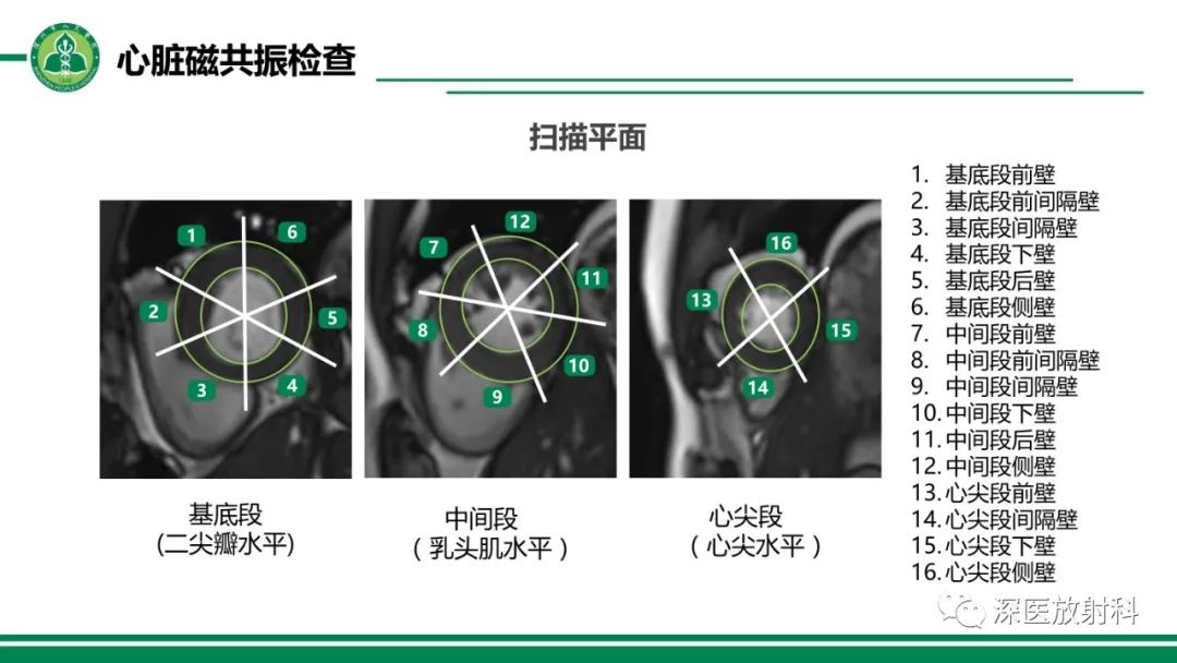影像PPT - 【PPT】心脏磁共振成像-9