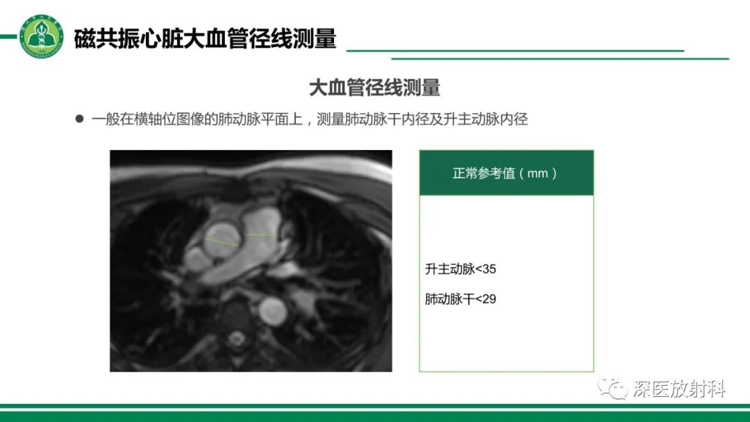 影像PPT - 【PPT】心脏磁共振成像-34
