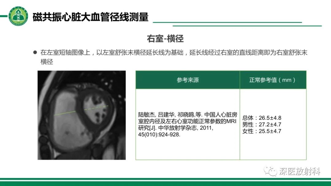 影像PPT - 【PPT】心脏磁共振成像-32