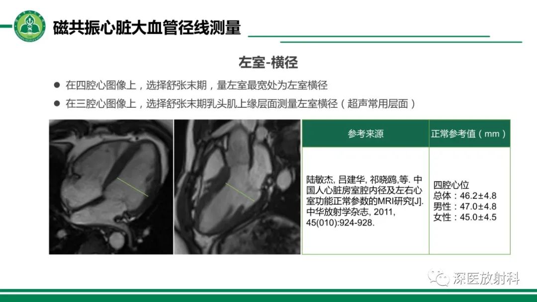 影像PPT - 【PPT】心脏磁共振成像-26