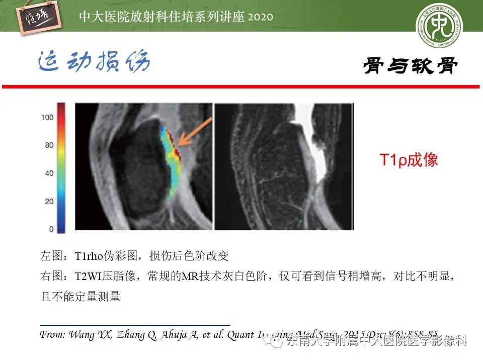 影像PPT - 【PPT】运动损伤的影像解读-21