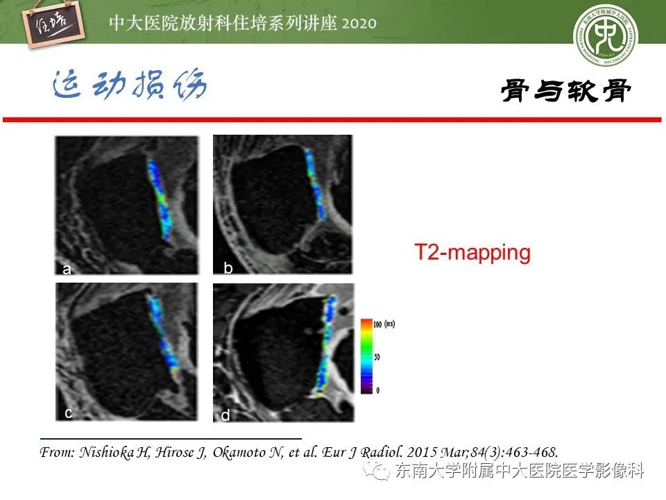 影像PPT - 【PPT】运动损伤的影像解读-22