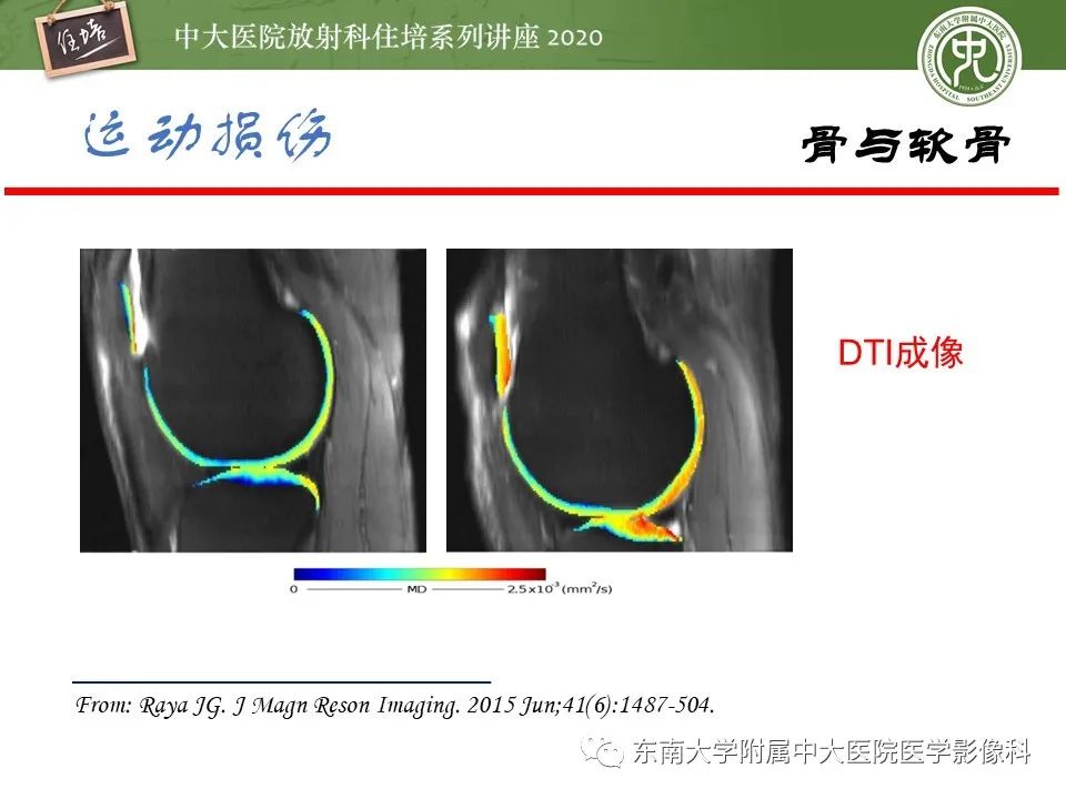 影像PPT - 【PPT】运动损伤的影像解读-23