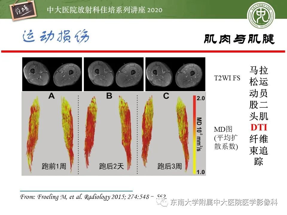 影像PPT - 【PPT】运动损伤的影像解读-46