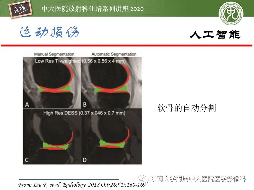 影像PPT - 【PPT】运动损伤的影像解读-57