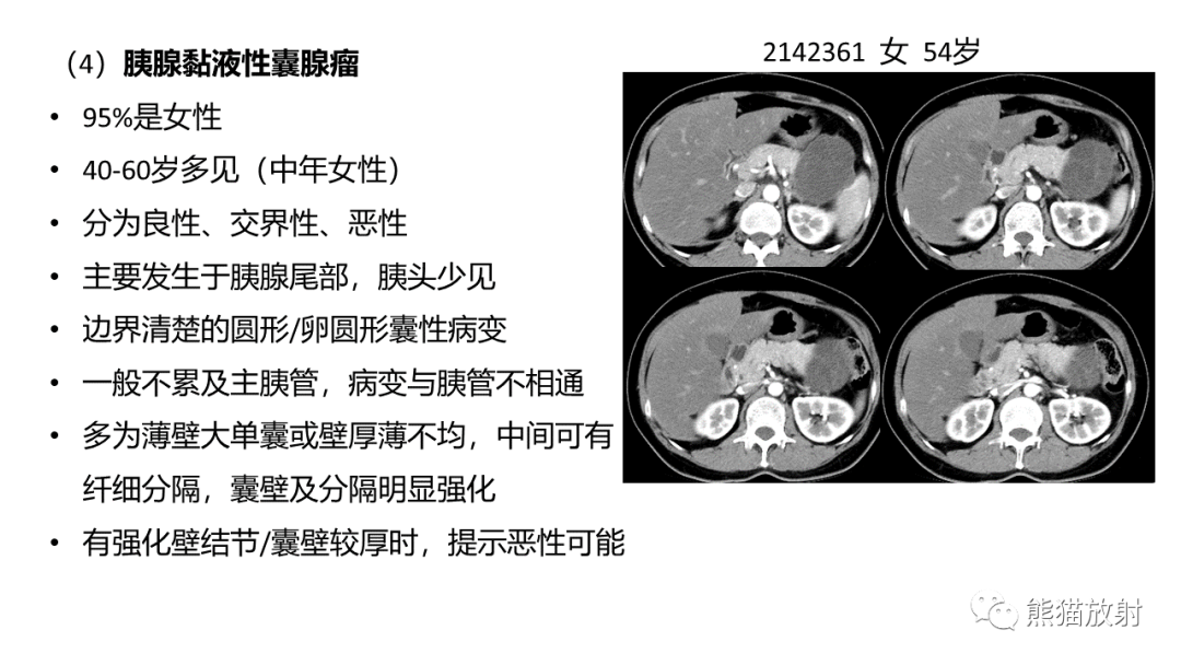 影像PPT - 【病例】粘液性囊腺瘤 VS 导管内乳头状粘液性肿瘤-41