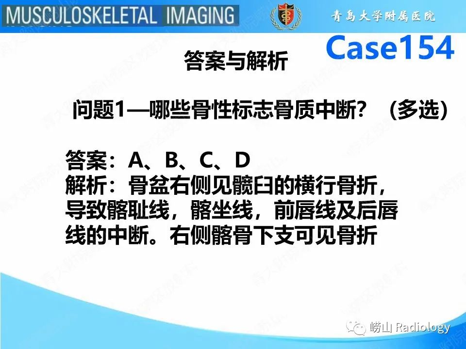 影像PPT - 【PPT】髋臼骨折-4