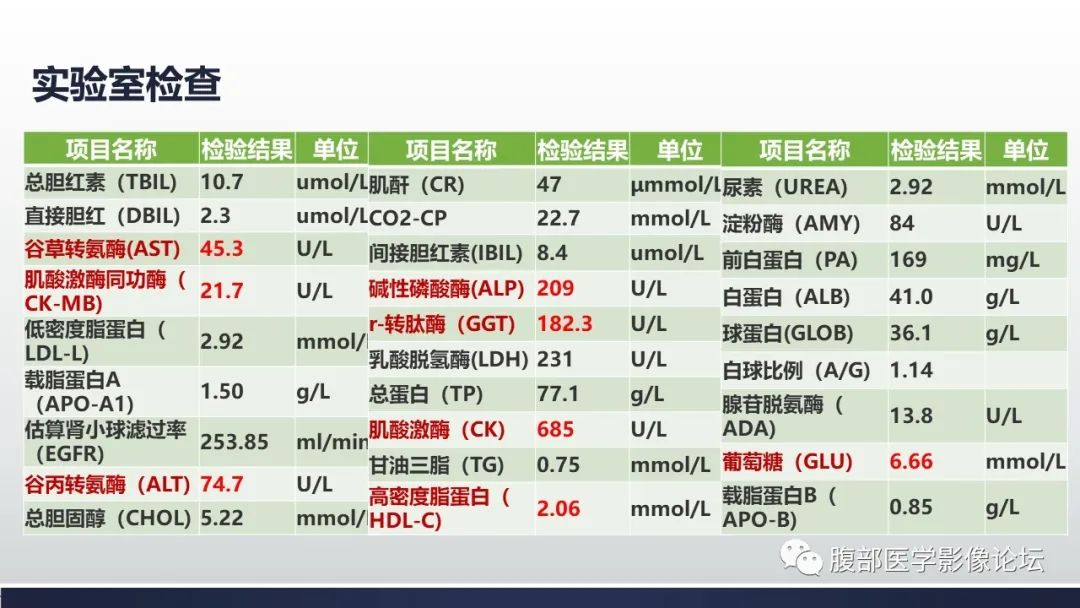 影像PPT - 【病例】肾嫌色细胞癌1例MR影像-5