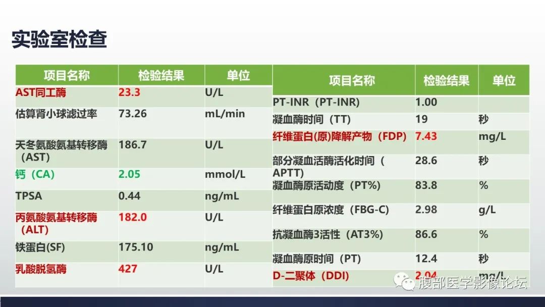 影像PPT - 【病例】肾嫌色细胞癌1例MR影像-4