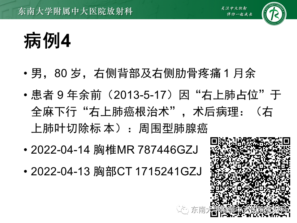 影像PPT - 【PPT】脊柱终板周围病变-10