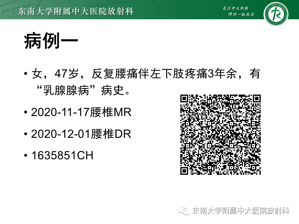 影像PPT - 【PPT】脊柱终板周围病变-1