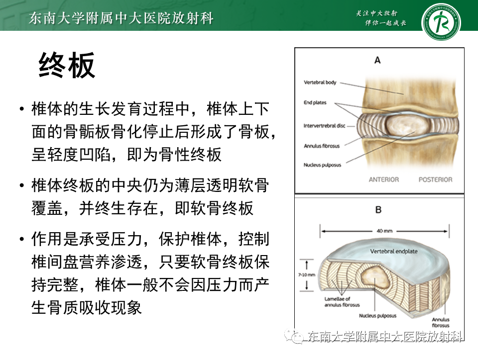 影像PPT - 【PPT】脊柱终板周围病变-16