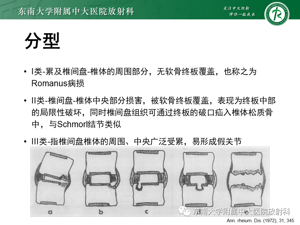影像PPT - 【PPT】脊柱终板周围病变-26