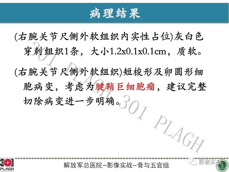 影像PPT - 【PPT】腕部腱鞘巨细胞瘤1例MR影像-9