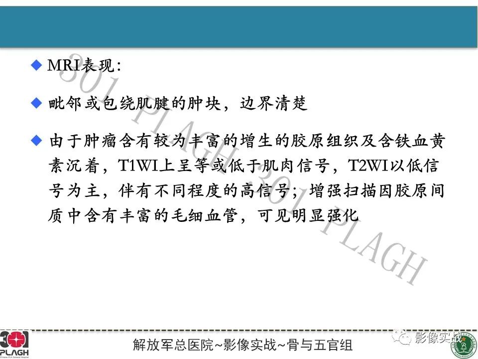 影像PPT - 【PPT】腕部腱鞘巨细胞瘤1例MR影像-13