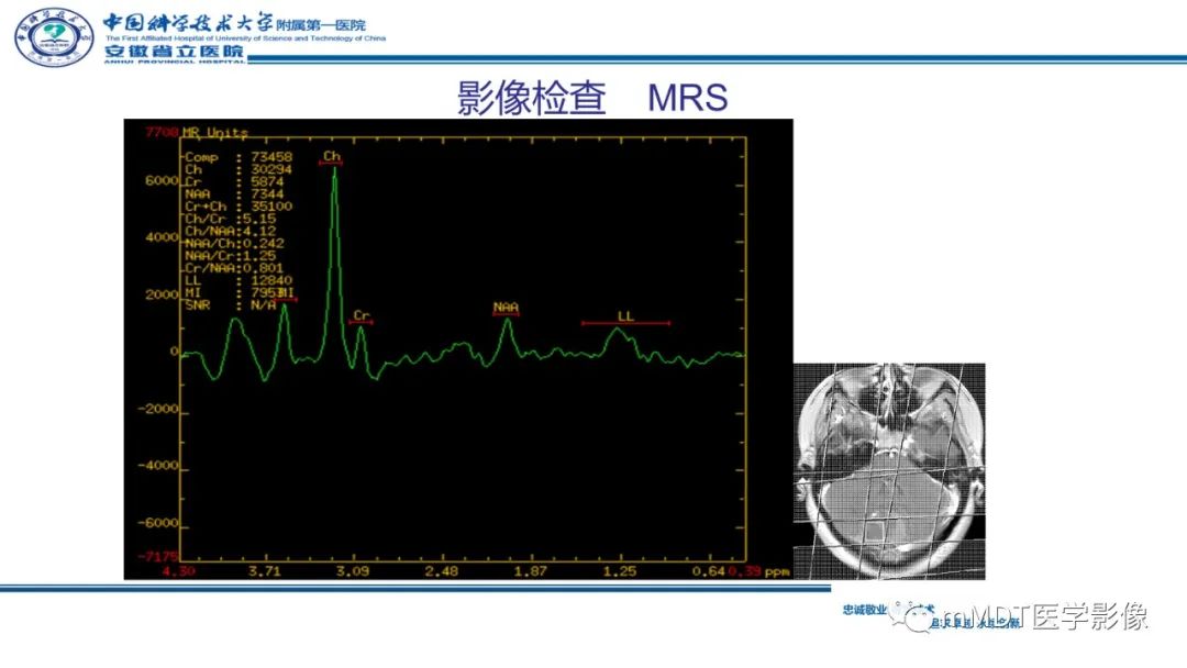 影像PPT - 【PPT】小脑髓母细胞瘤病例解析-17
