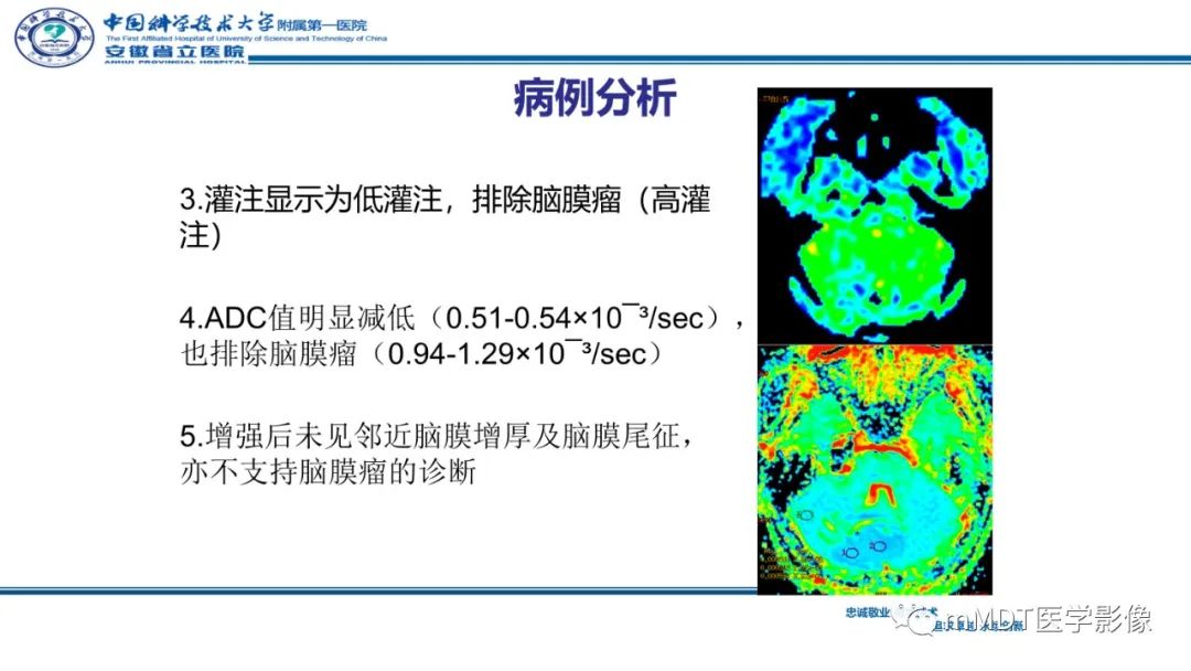 影像PPT - 【PPT】小脑髓母细胞瘤病例解析-21