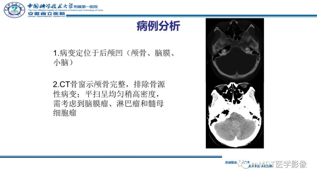 影像PPT - 【PPT】小脑髓母细胞瘤病例解析-20