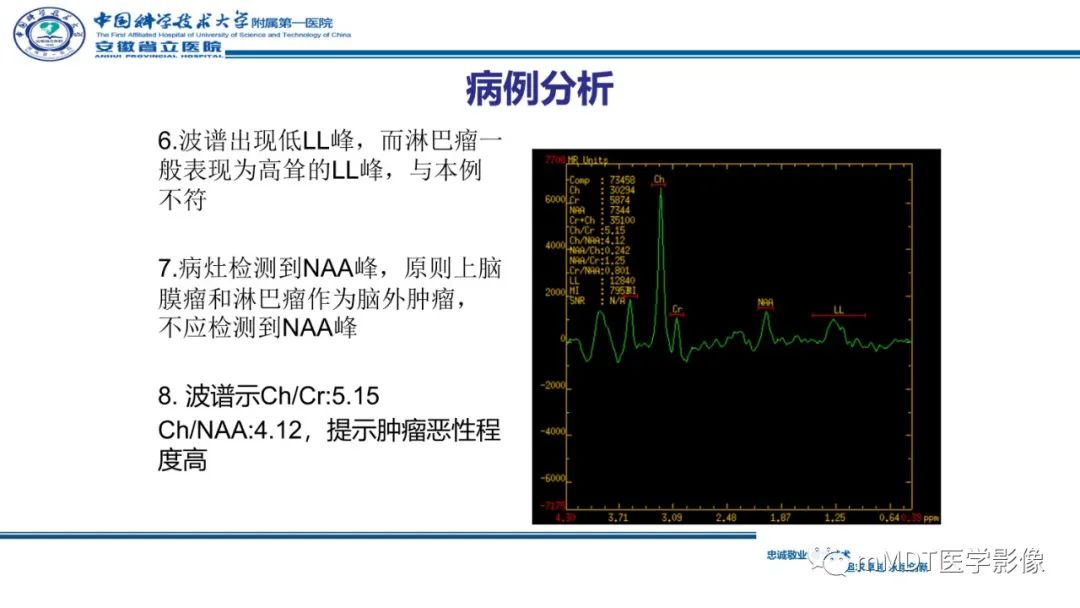 影像PPT - 【PPT】小脑髓母细胞瘤病例解析-22