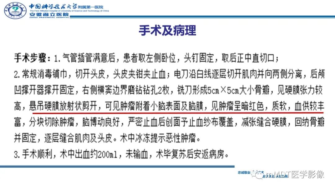 影像PPT - 【PPT】小脑髓母细胞瘤病例解析-24