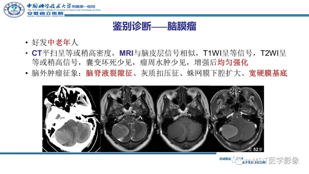 影像PPT - 【PPT】小脑髓母细胞瘤病例解析-29