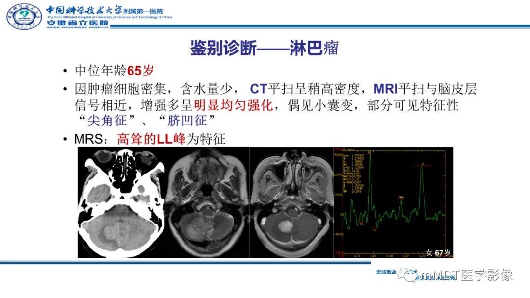 影像PPT - 【PPT】小脑髓母细胞瘤病例解析-30