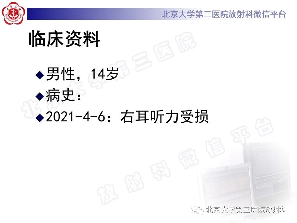 影像PPT - 【PPT】先天性内耳畸形-2
