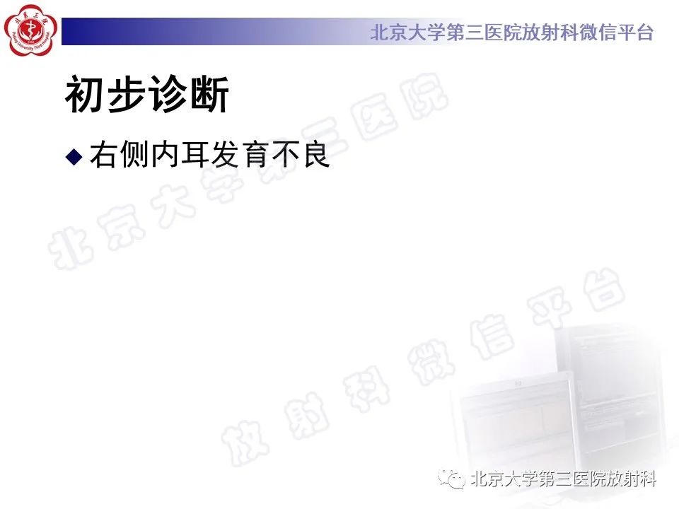 影像PPT - 【PPT】先天性内耳畸形-6