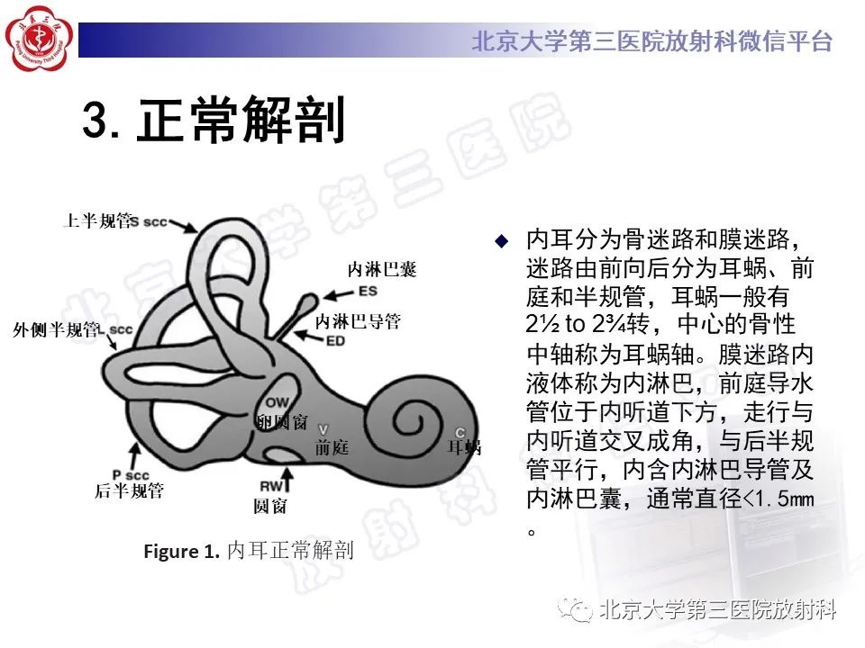 影像PPT - 【PPT】先天性内耳畸形-10