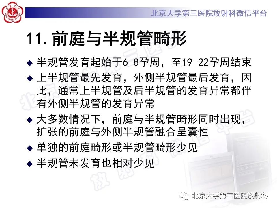 影像PPT - 【PPT】先天性内耳畸形-27