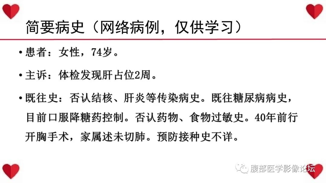 影像PPT - 【病例】肝脏血管肉瘤1例CT及MR影像解析-2
