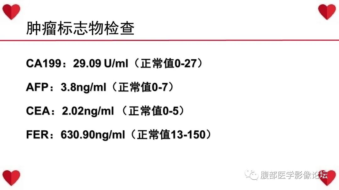 影像PPT - 【病例】肝脏血管肉瘤1例CT及MR影像解析-3
