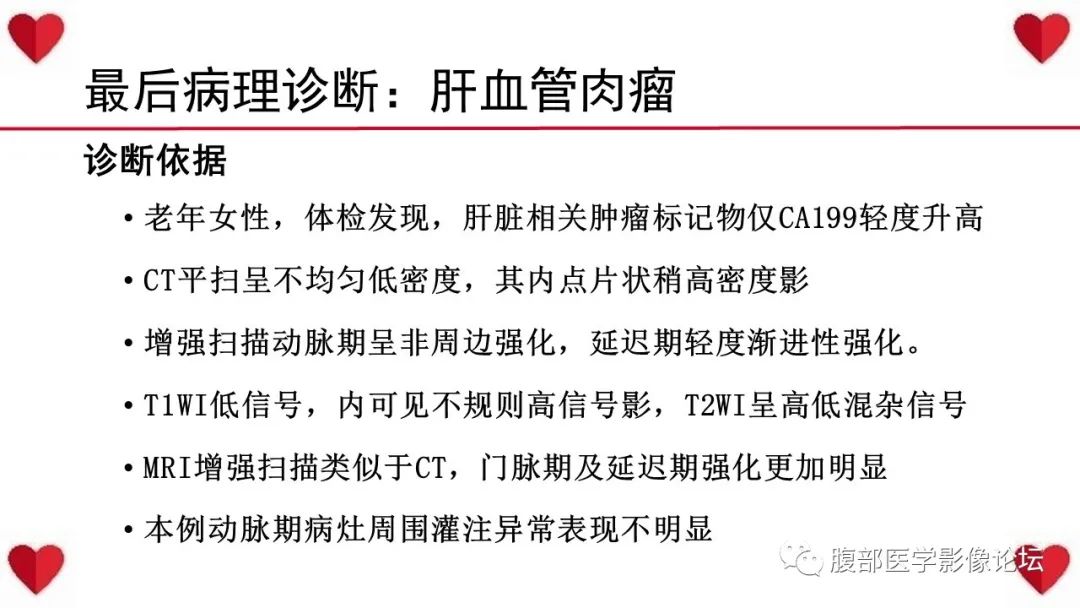 影像PPT - 【病例】肝脏血管肉瘤1例CT及MR影像解析-16