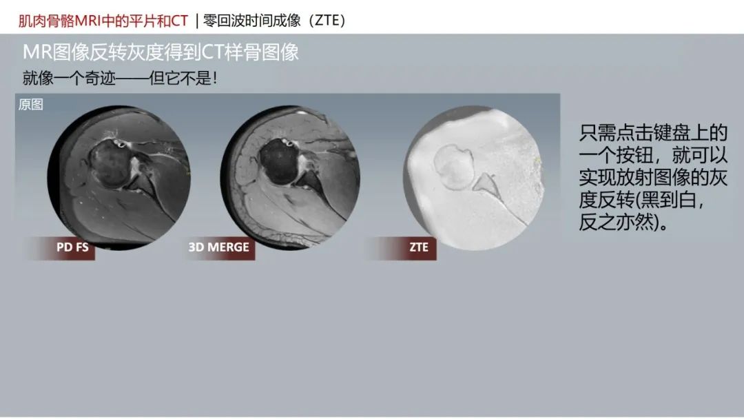 影像PPT - 【PPT】肌肉骨骼MRI中的平片和CT——零回波时间（ZTE）成像的挑战、优化和应用-3