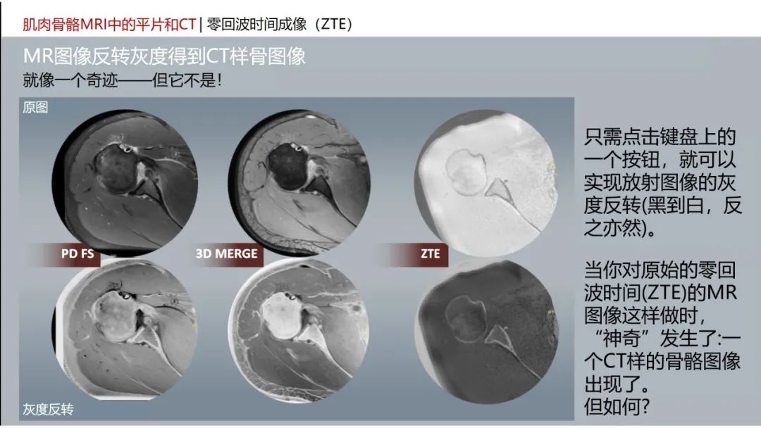 影像PPT - 【PPT】肌肉骨骼MRI中的平片和CT——零回波时间（ZTE）成像的挑战、优化和应用-5