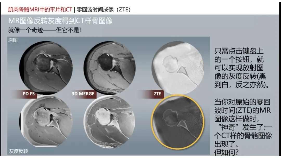 影像PPT - 【PPT】肌肉骨骼MRI中的平片和CT——零回波时间（ZTE）成像的挑战、优化和应用-7