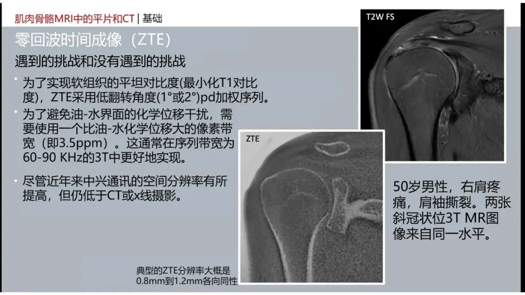 影像PPT - 【PPT】肌肉骨骼MRI中的平片和CT——零回波时间（ZTE）成像的挑战、优化和应用-15