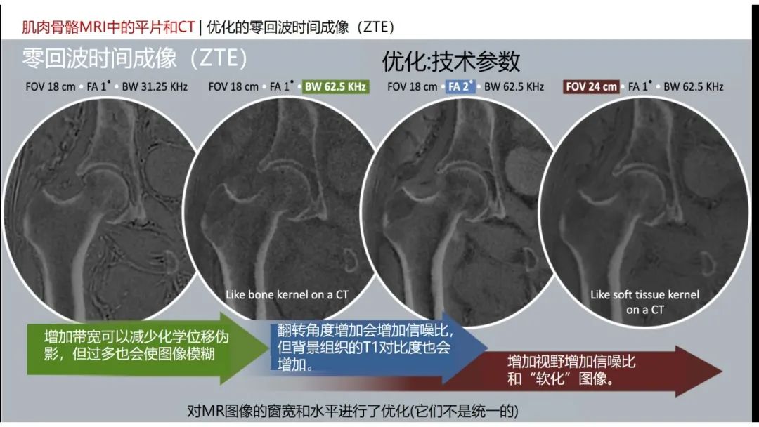 影像PPT - 【PPT】肌肉骨骼MRI中的平片和CT——零回波时间（ZTE）成像的挑战、优化和应用-17