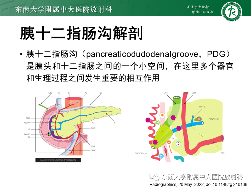 影像PPT - 【PPT】局灶型IgG4相关性自身免疫性胰腺炎-7