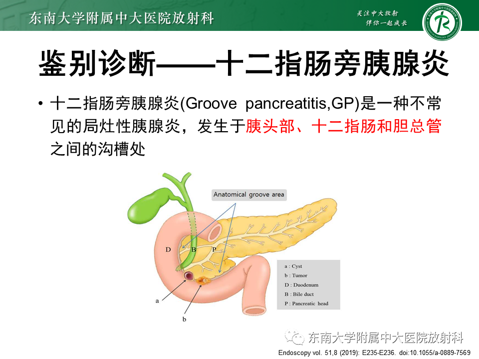 影像PPT - 【PPT】局灶型IgG4相关性自身免疫性胰腺炎-22