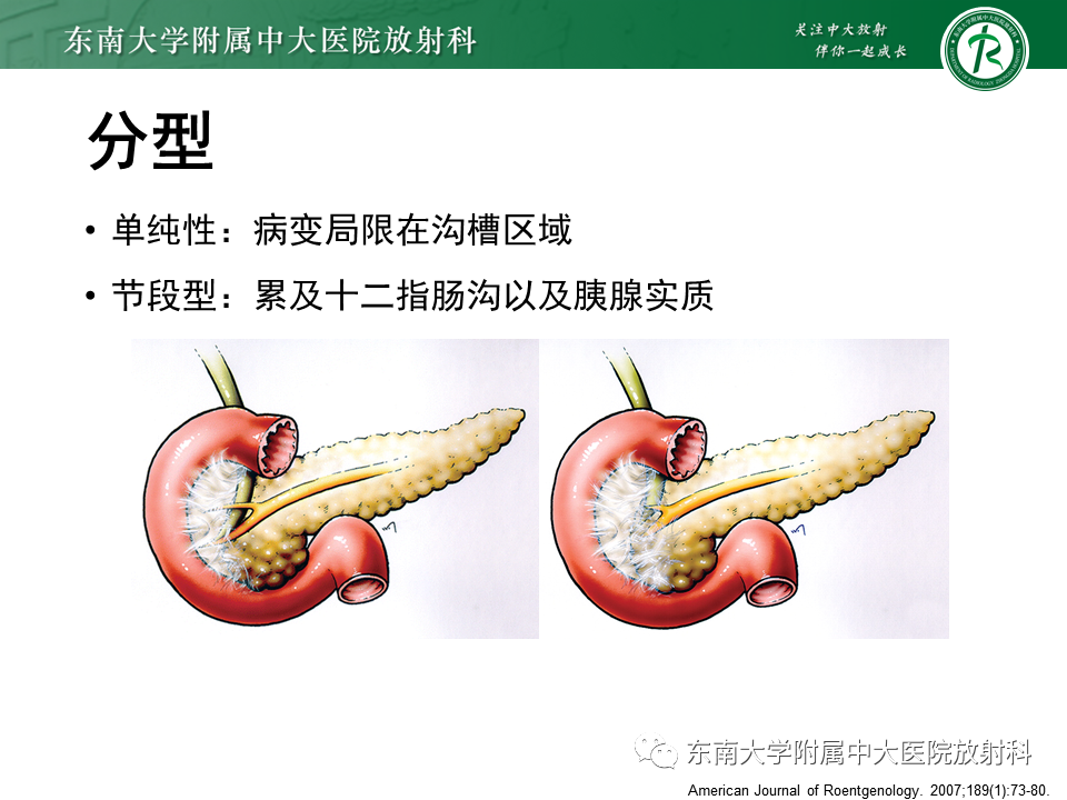 影像PPT - 【PPT】局灶型IgG4相关性自身免疫性胰腺炎-23