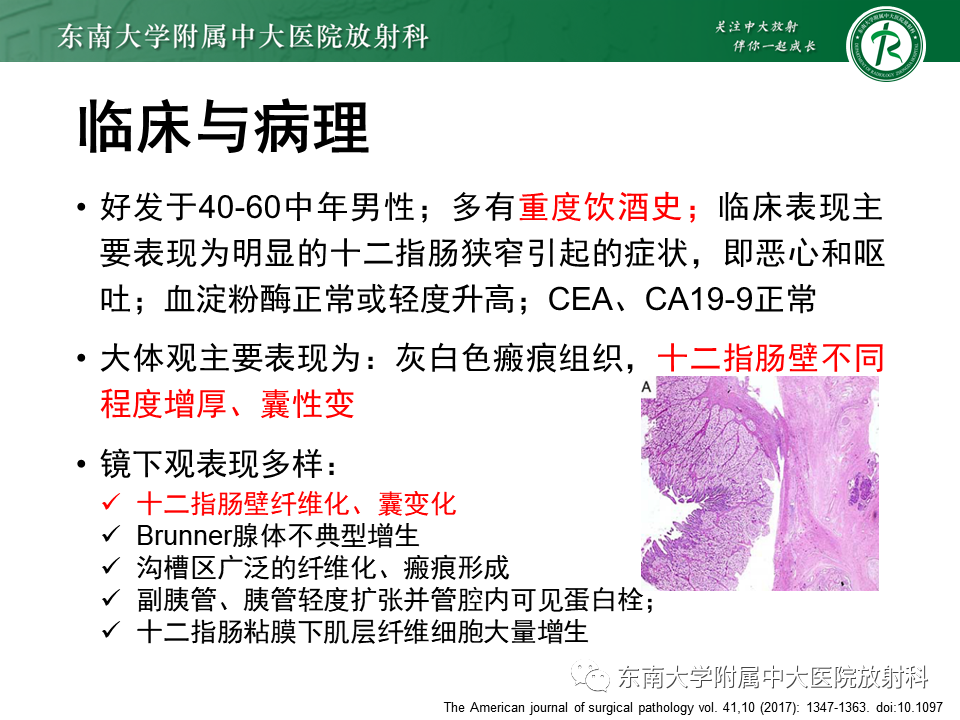 影像PPT - 【PPT】局灶型IgG4相关性自身免疫性胰腺炎-25